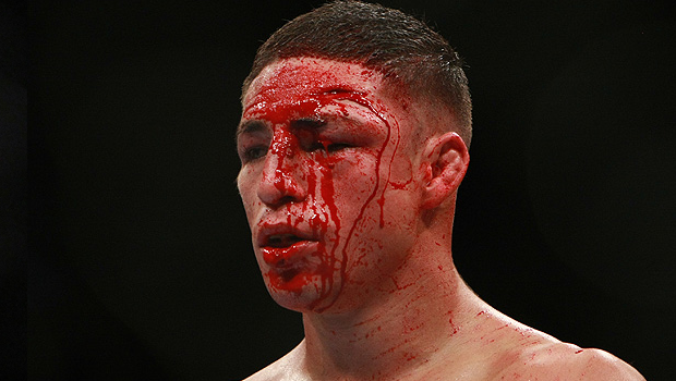 Diego-sanchez