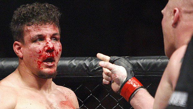 Frank-mir