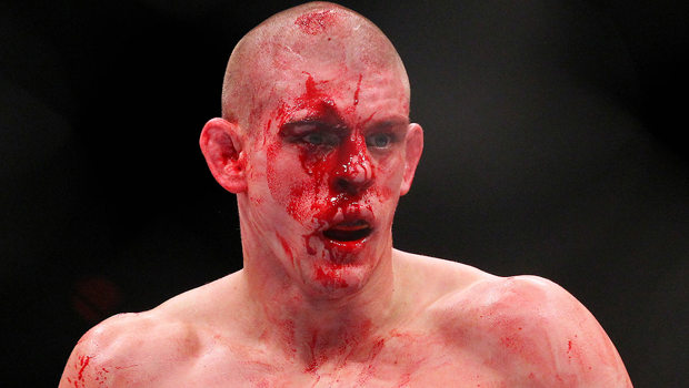 joe-lauzon