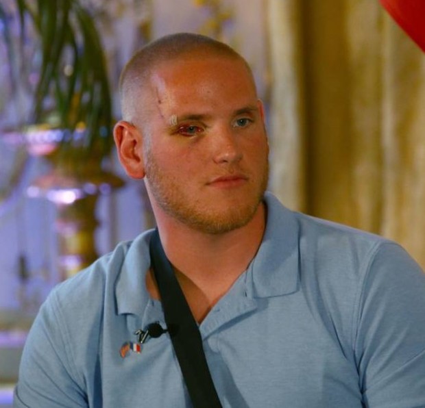 Spencer Stone efter attacken i Frankrike.